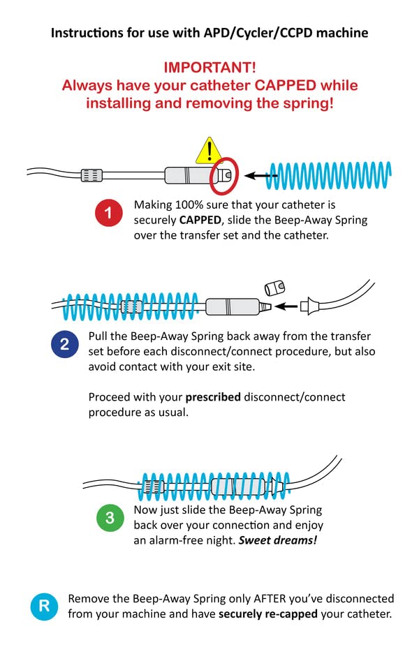 Beep-Away Spring Peritoneal Dialysis Alarm Reducer